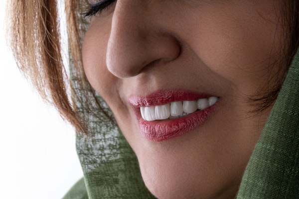 Blanchiment dentaire sourire